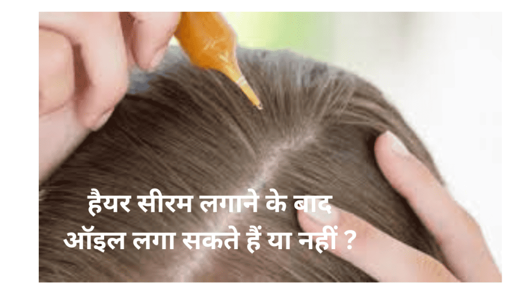 Vedix Hair Kit Review in Hindi  बल क झडन रक  Aesthetic Grooming